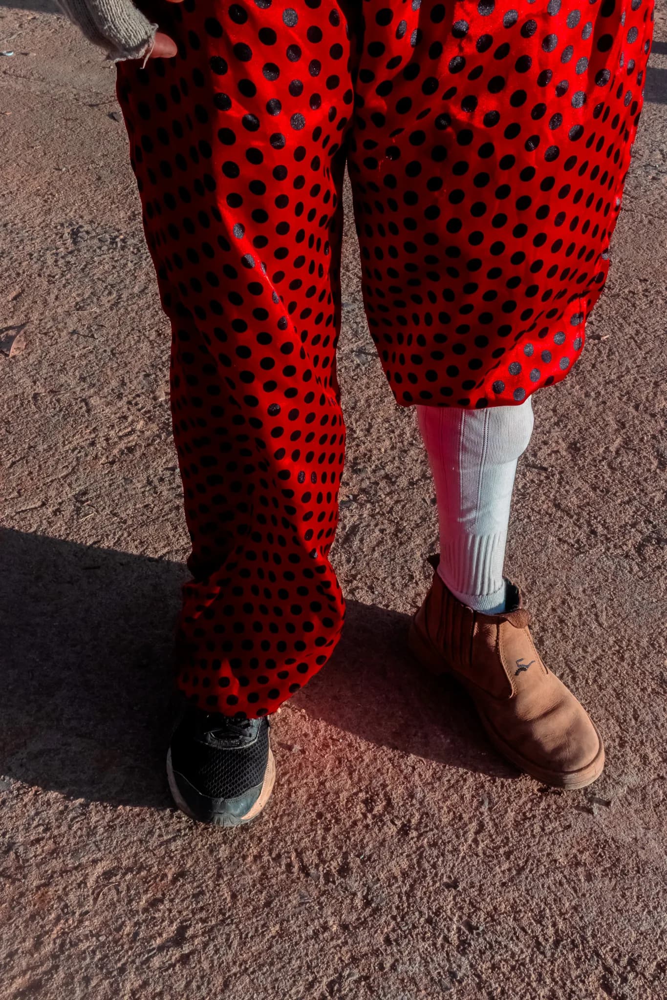 Close on red polka dot trousers, one leg wrapped in a bandage, sneakers on the dirt.